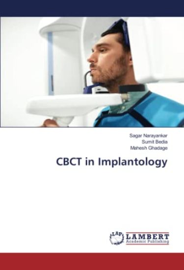 CBCT in Implantology