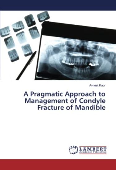 A Pragmatic Approach to Management of Condyle Fracture of Mandible