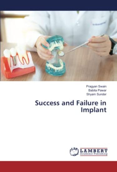 Success and Failure in Implant