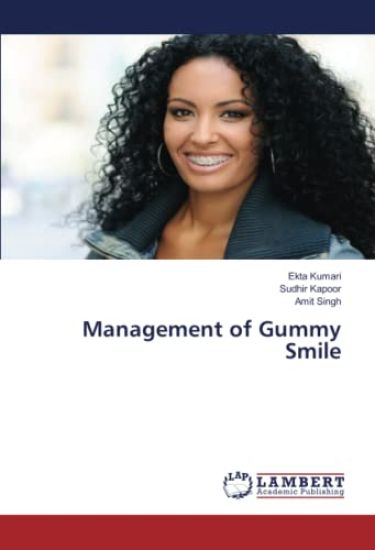 Management of Gummy Smile