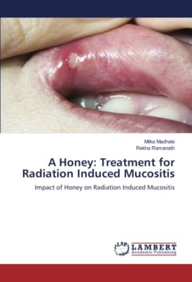 A Honey: Treatment for Radiation Induced Mucositis