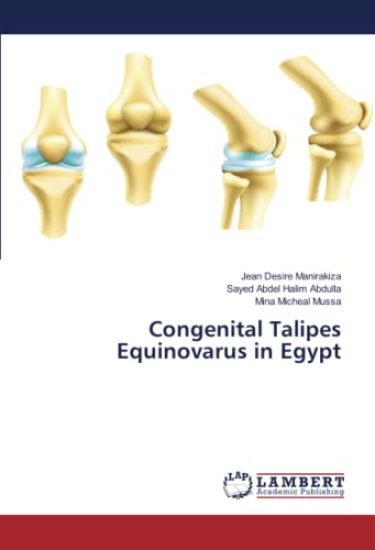 Congenital Talipes Equinovarus in Egypt