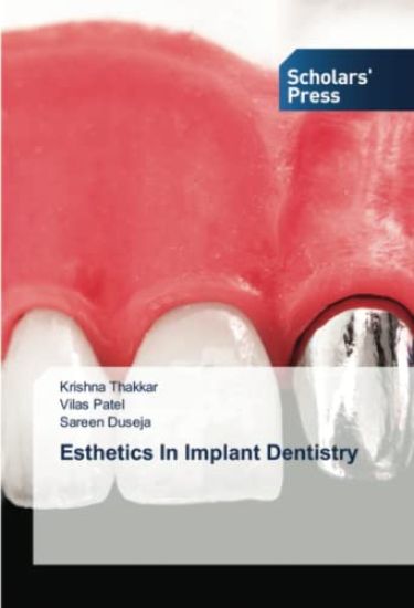 Esthetics In Implant Dentistry