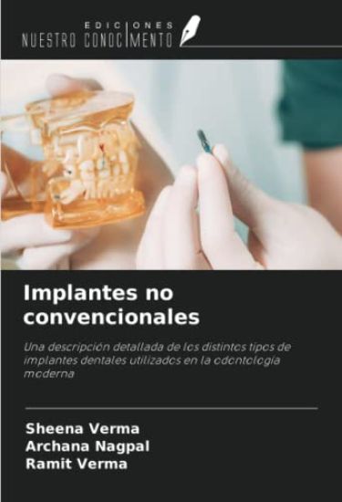 Implantes no convencionales