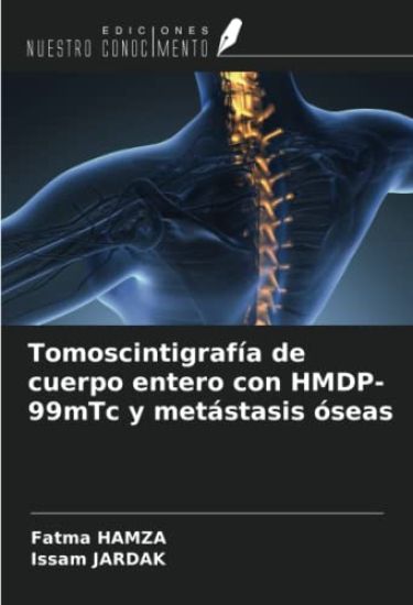 Tomoscintigrafía de cuerpo entero con HMDP-99mTc y metástasis óseas