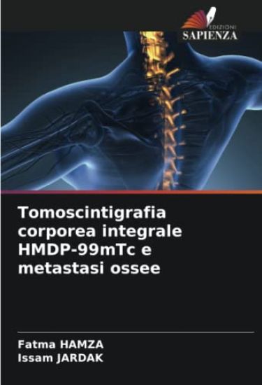 Tomoscintigrafia corporea integrale HMDP-99mTc e metastasi ossee