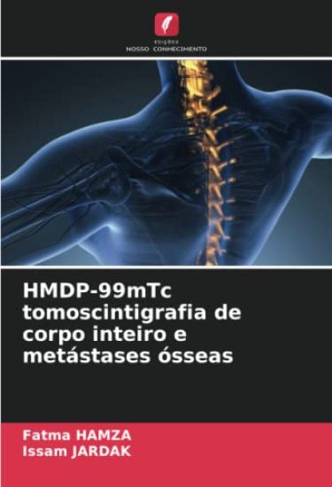 HMDP-99mTc tomoscintigrafia de corpo inteiro e metástases ósseas