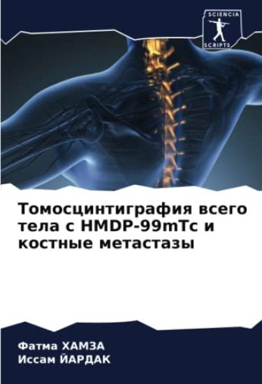 Tomoscintigrafiq wsego tela s HMDP-99mTc i kostnye metastazy