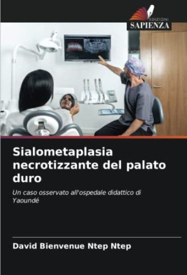 Sialometaplasia necrotizzante del palato duro