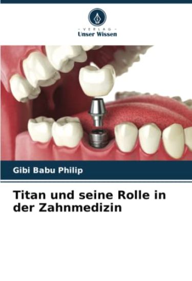 Titan und seine Rolle in der Zahnmedizin