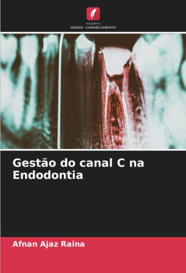 Gestão do canal C na Endodontia