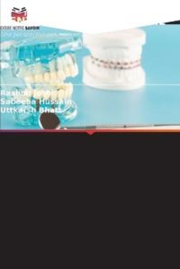 Les Empreintes En Dentisterie Implantaire