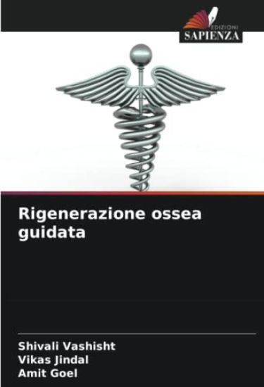 Rigenerazione ossea guidata