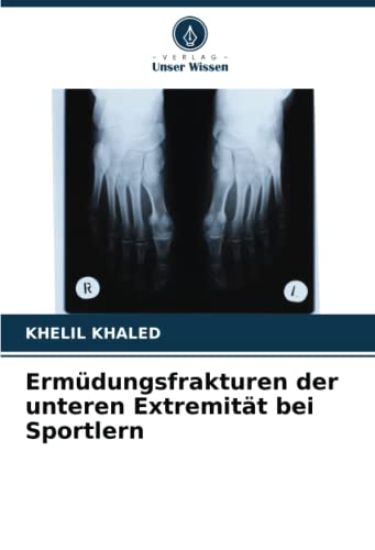 Ermüdungsfrakturen der unteren Extremität bei Sportlern