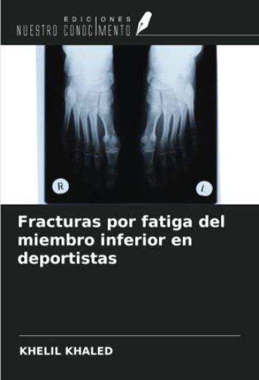 Fracturas por fatiga del miembro inferior en deportistas