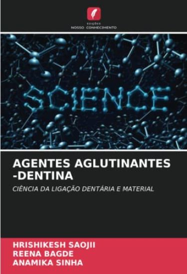Agentes Aglutinantes -Dentina