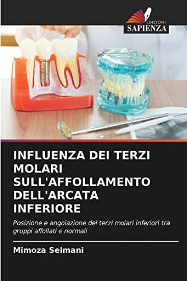 Influenza Dei Terzi Molari Sull'affollamento Dell'arcata Inferiore