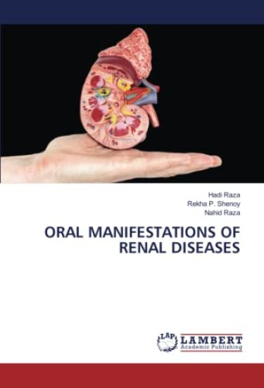 Oral Manifestations of Renal Diseases