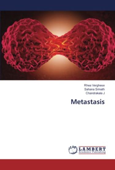 Metastasis