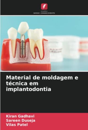 Material de moldagem e técnica em implantodontia