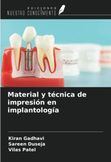 Material y técnica de impresión en implantología