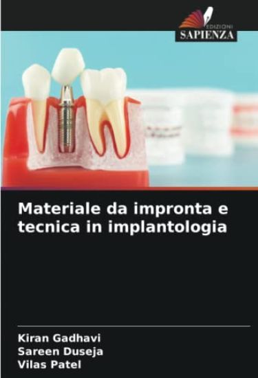Materiale da impronta e tecnica in implantologia