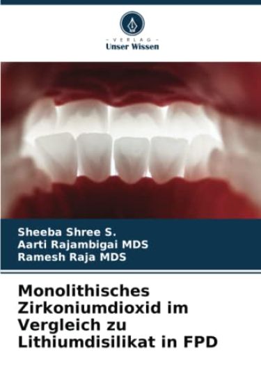 Monolithisches Zirkoniumdioxid im Vergleich zu Lithiumdisilikat in FPD