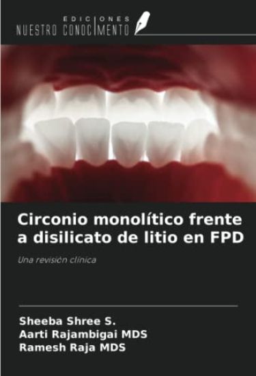 Circonio monolítico frente a disilicato de litio en FPD