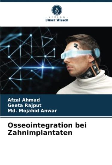 Osseointegration bei Zahnimplantaten