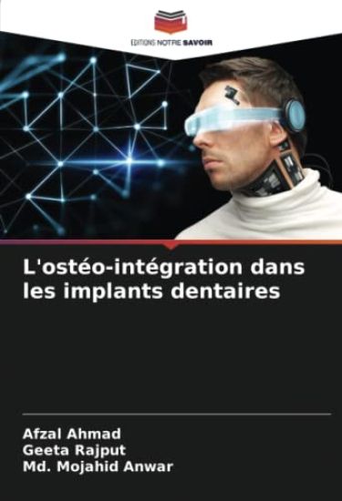 L'ostéo-intégration dans les implants dentaires