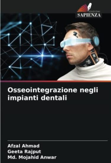 Osseointegrazione negli impianti dentali