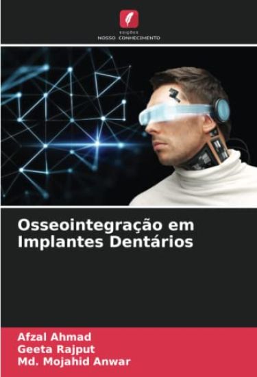 Osseointegração em Implantes Dentários