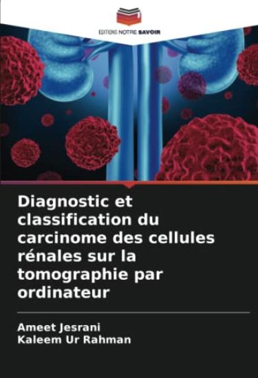 Diagnostic et classification du carcinome des cellules rénales sur la tomographie par ordinateur