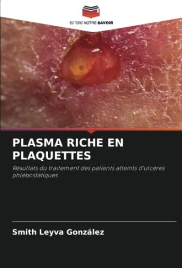 Plasma Riche En Plaquettes