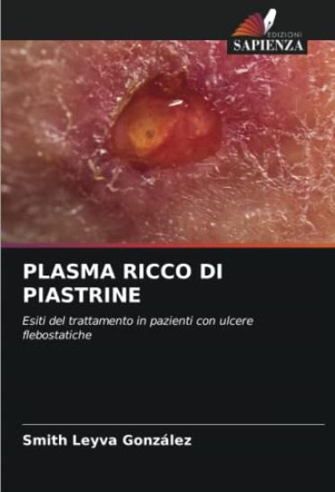 Plasma Ricco Di Piastrine