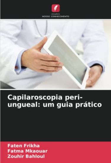 Capilaroscopia peri-ungueal