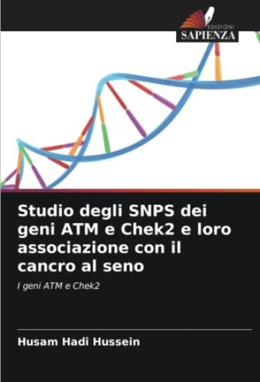Studio degli SNPS dei geni ATM e Chek2 e loro associazione con il cancro al seno