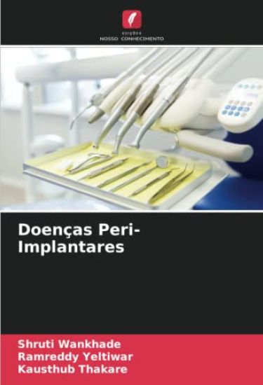 Doenças Peri-Implantares