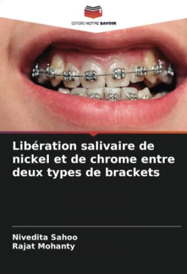 Libération salivaire de nickel et de chrome entre deux types de brackets