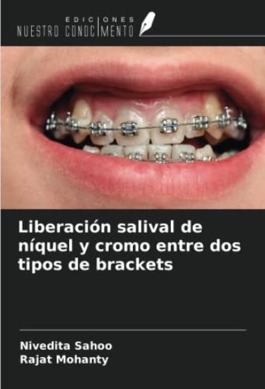 Liberación salival de níquel y cromo entre dos tipos de brackets