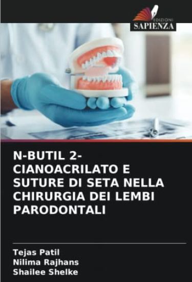 N-Butil 2-Cianoacrilato E Suture Di Seta Nella Chirurgia Dei Lembi Parodontali