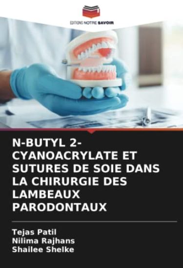 N-Butyl 2-Cyanoacrylate Et Sutures de Soie Dans La Chirurgie Des Lambeaux Parodontaux