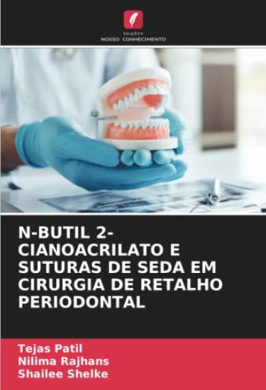 N-Butil 2-Cianoacrilato E Suturas de Seda Em Cirurgia de Retalho Periodontal