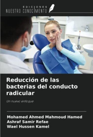 Reducción de las bacterias del conducto radicular