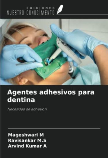 Agentes adhesivos para dentina