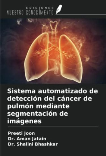 Sistema automatizado de detección del cáncer de pulmón mediante segmentación de imágenes