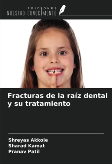 Fracturas de la raíz dental y su tratamiento