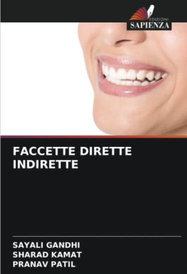 Faccette Dirette Indirette