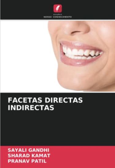 Facetas Directas Indirectas