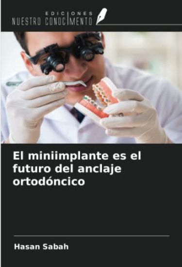 El miniimplante es el futuro del anclaje ortodóncico